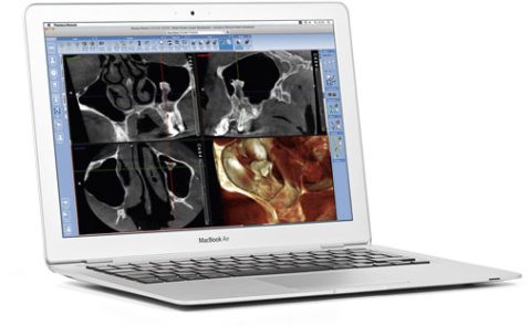 Як відкрити та прочитати диски КТ та МРТ?